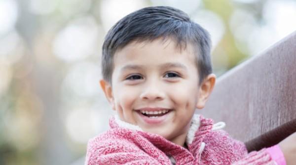 Lesung Pipi, Kelainan