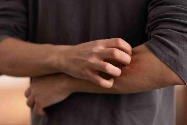 cara membersihkan kasur agar terbebas dari kutu busuk