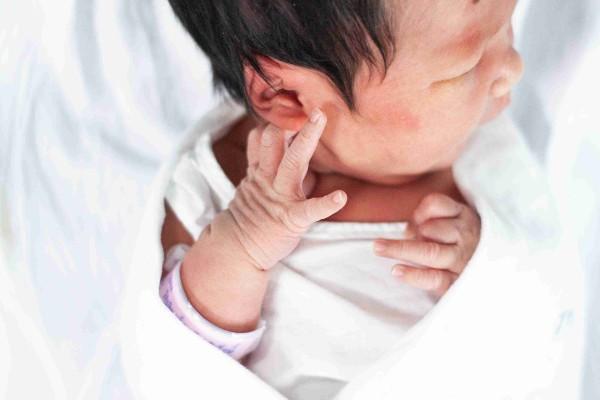 bayi garuk telinga
