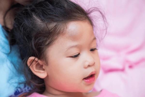 Hal yang Harus Diperhatikan saat Anak Kejedot!