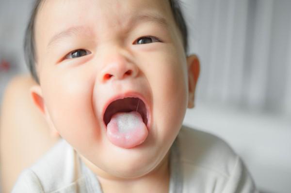 Tanda Penyakit dari Lidah pada Anak