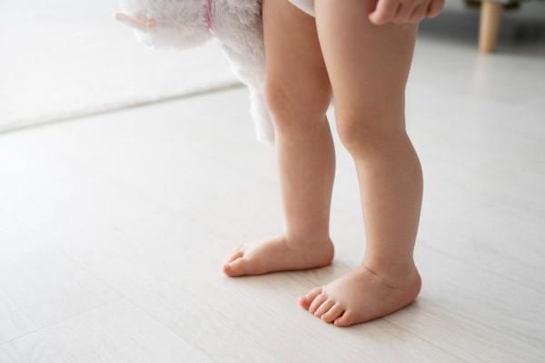 Flat Foot pada Anak