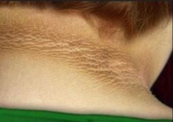 /artikel/tanda-gula-darah-tinggi-yang-terlihat-dari-kulit/'s thumbnail