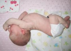 /artikel/melengkungkan-badan-tanda-gerd-pada-anak/'s thumbnail