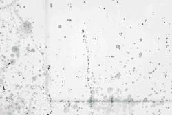 /artikel/mengenal-black-mold-jamur-hitam-penyebab-asma-pneumonia/'s thumbnail