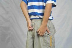 /artikel/infeksi-cacing-kremi/'s thumbnail