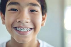 /artikel/cara-cegah-anak-pakai-behel/'s thumbnail